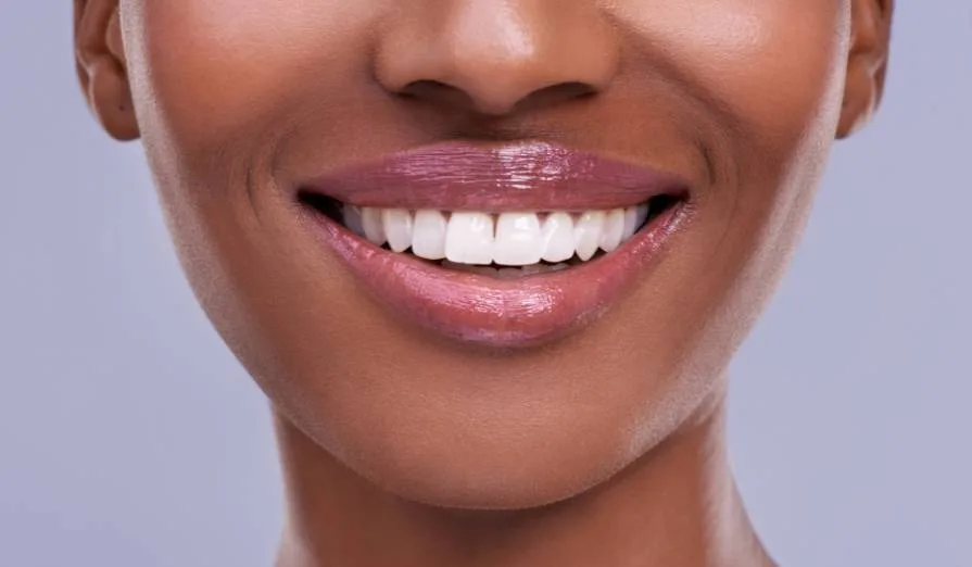professional teeth whitening treatment at Deans Dental Nairobi